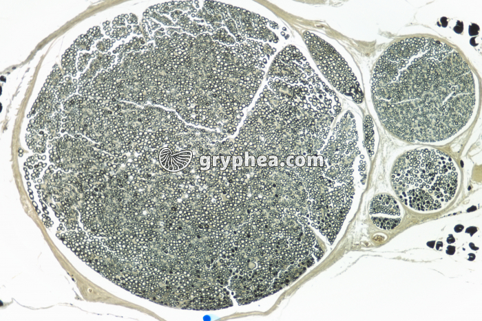 Nerf CT x15 - gryphea.com